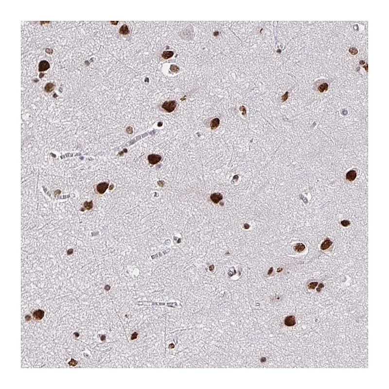 Atlas Antibodies Anti-ZNF579 Antibody