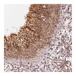 Atlas Antibodies Anti-ZNF580 Antibody