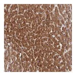 Atlas Antibodies Anti-ZNF584 Antibody