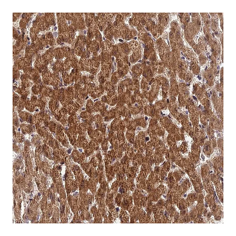 Atlas Antibodies Anti-ZNF584 Antibody