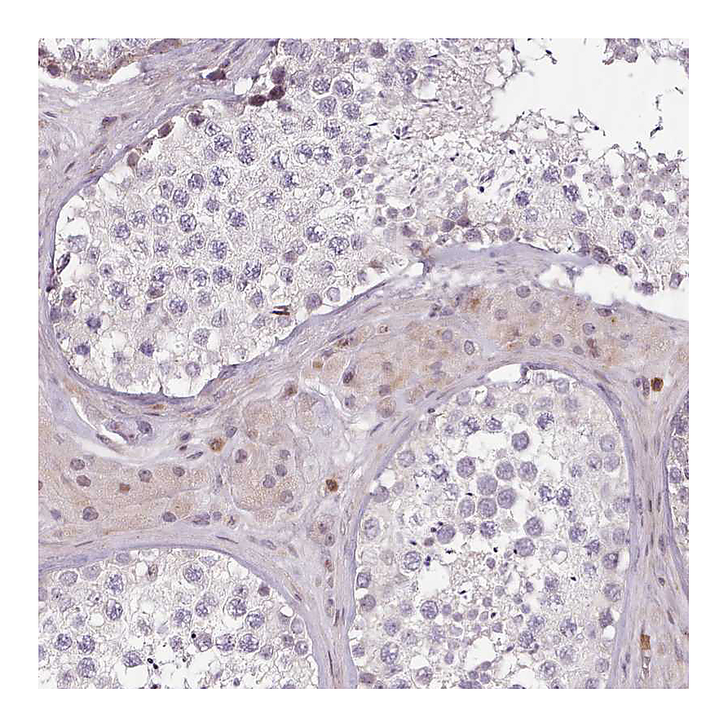 Atlas Antibodies Anti-ZNF583 Antibody