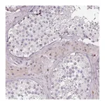 Atlas Antibodies Anti-ZNF583 Antibody