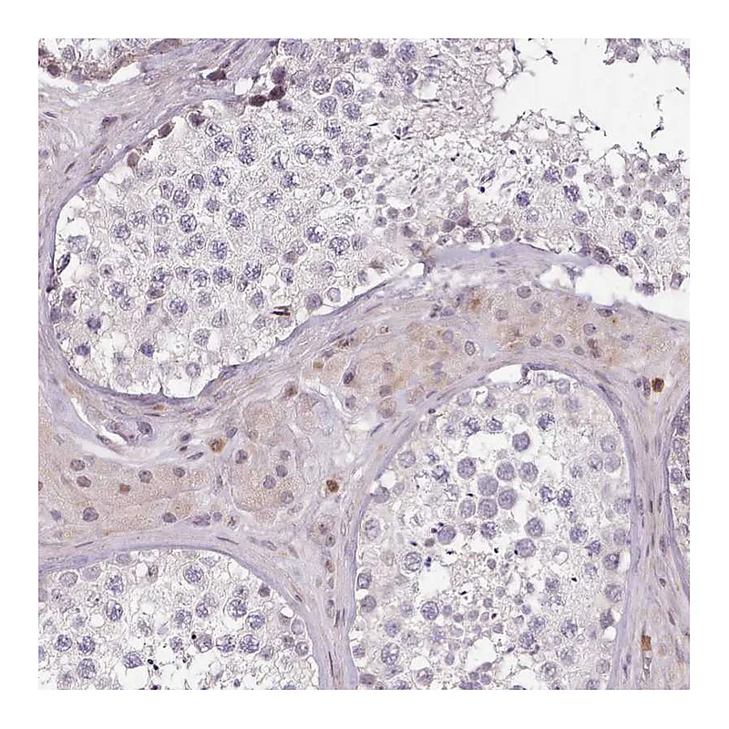 Atlas Antibodies Anti-ZNF583 Antibody