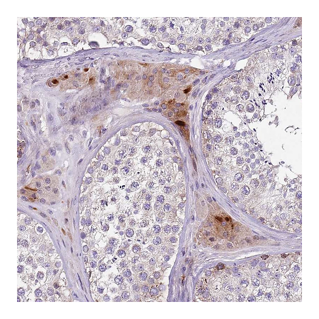 Atlas Antibodies Anti-ZNF583 Antibody
