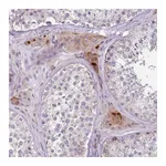 Atlas Antibodies Anti-ZNF583 Antibody