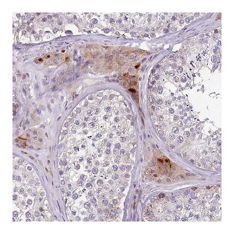 Atlas Antibodies Anti-ZNF583 Antibody