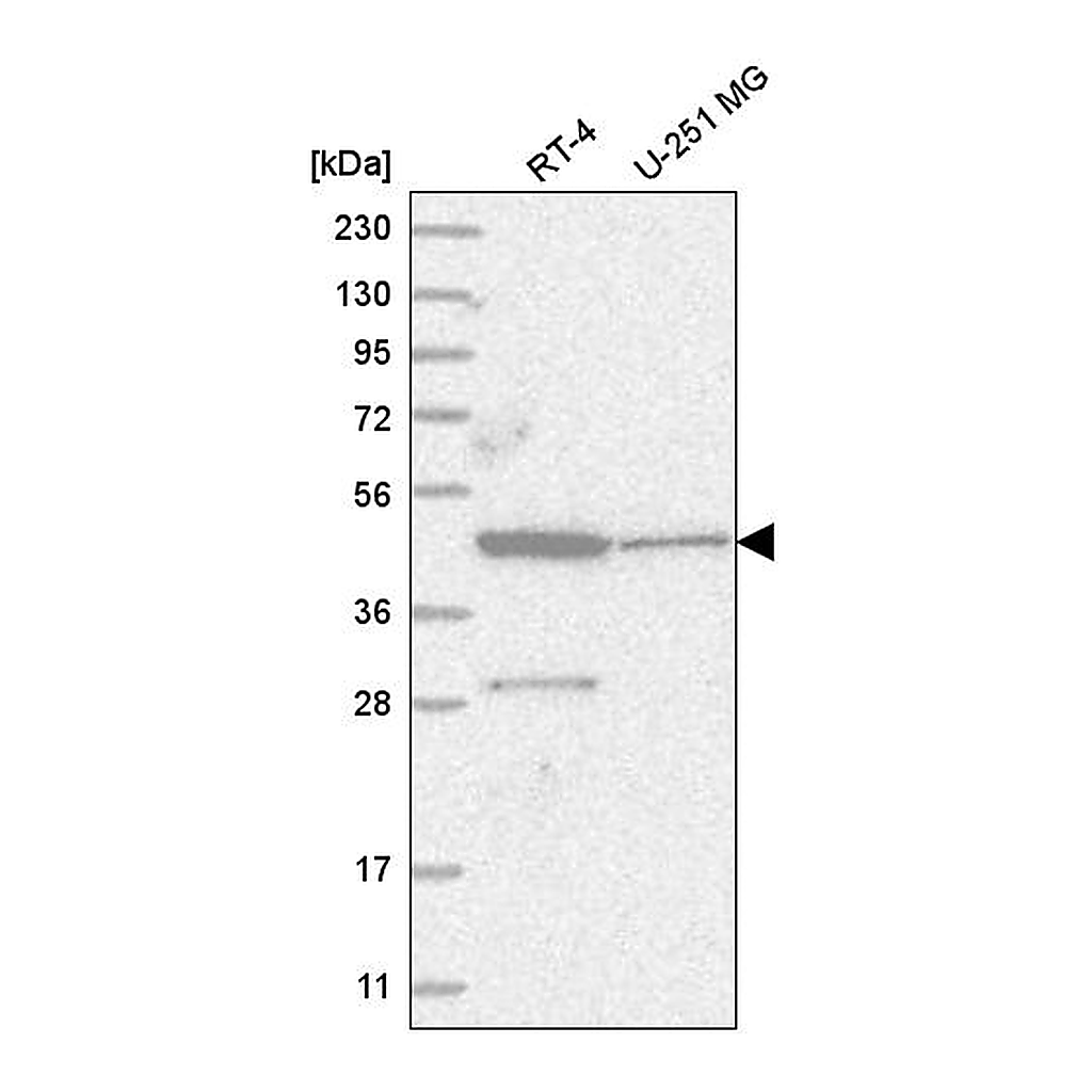 Atlas Antibodies Anti-ZNF586 Antibody