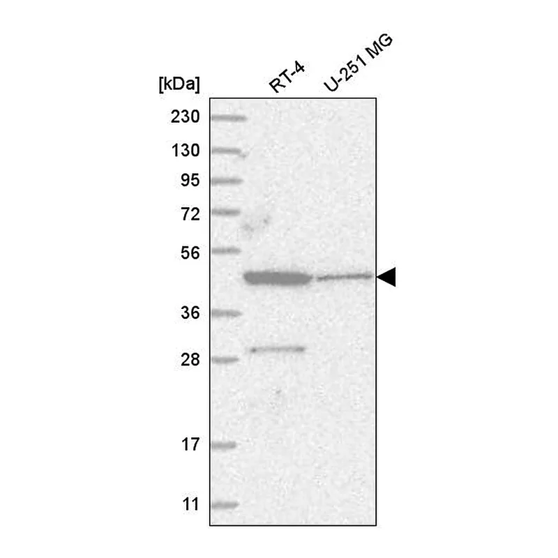 Atlas Antibodies Anti-ZNF586 Antibody