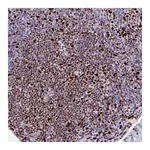 Atlas Antibodies Anti-ZNF586 Antibody