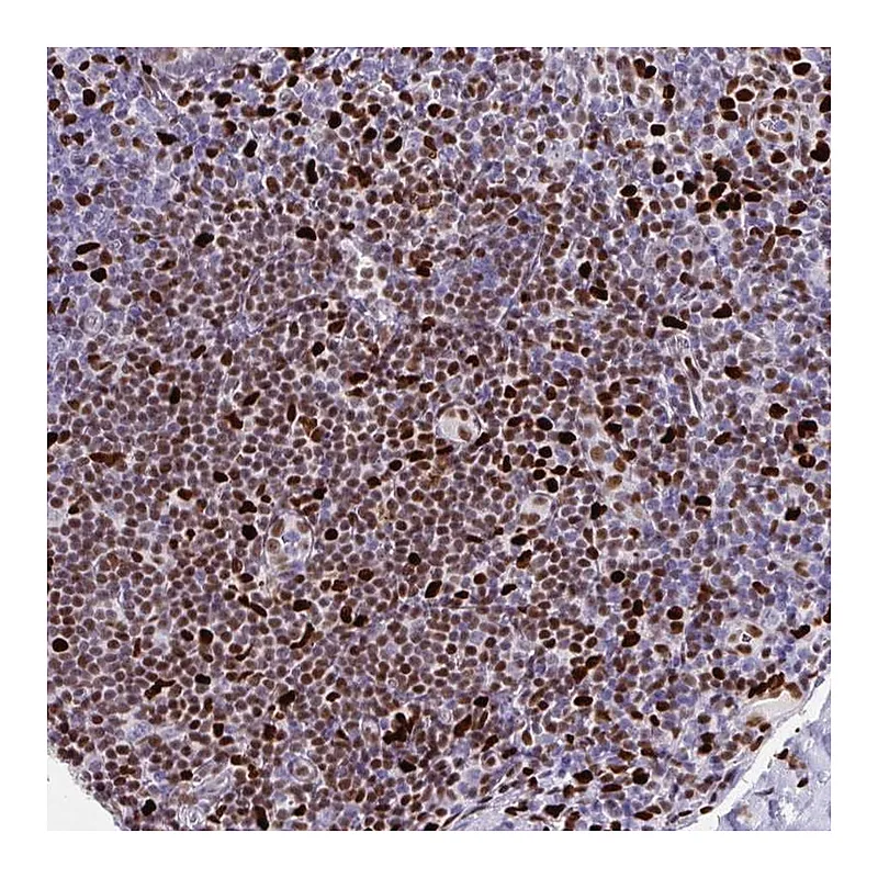 Atlas Antibodies Anti-ZNF586 Antibody
