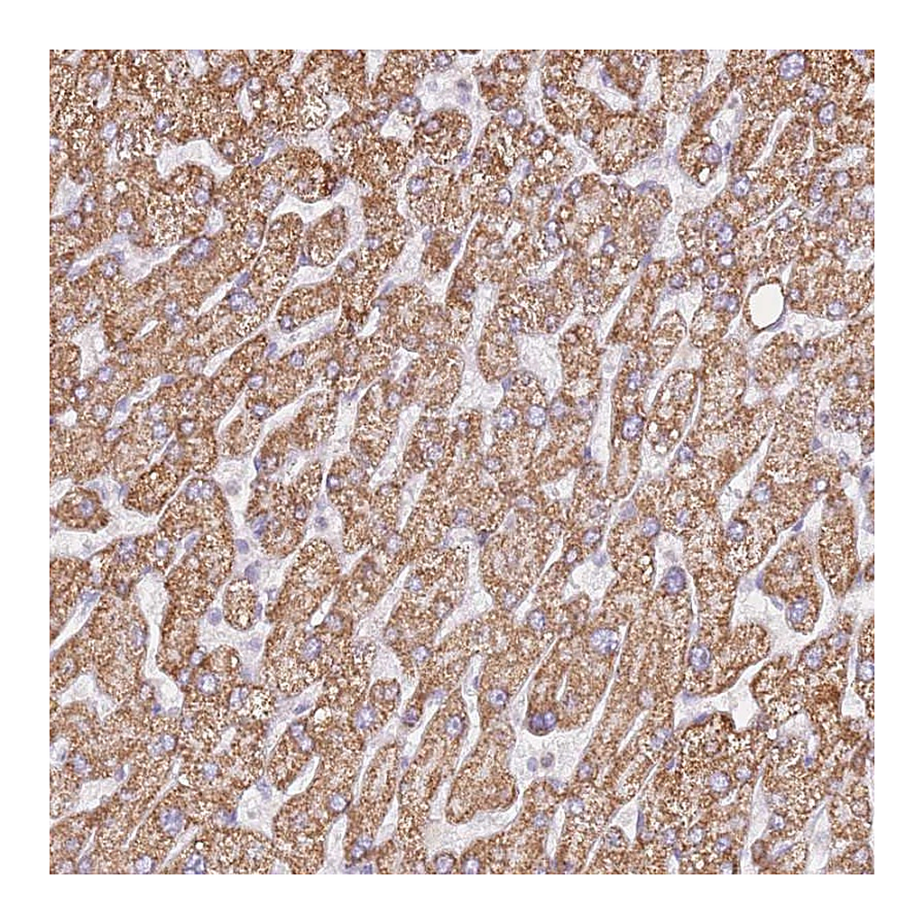 Atlas Antibodies Anti-ZNF584 Antibody
