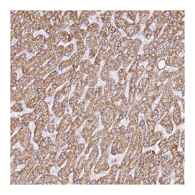 Atlas Antibodies Anti-ZNF584 Antibody
