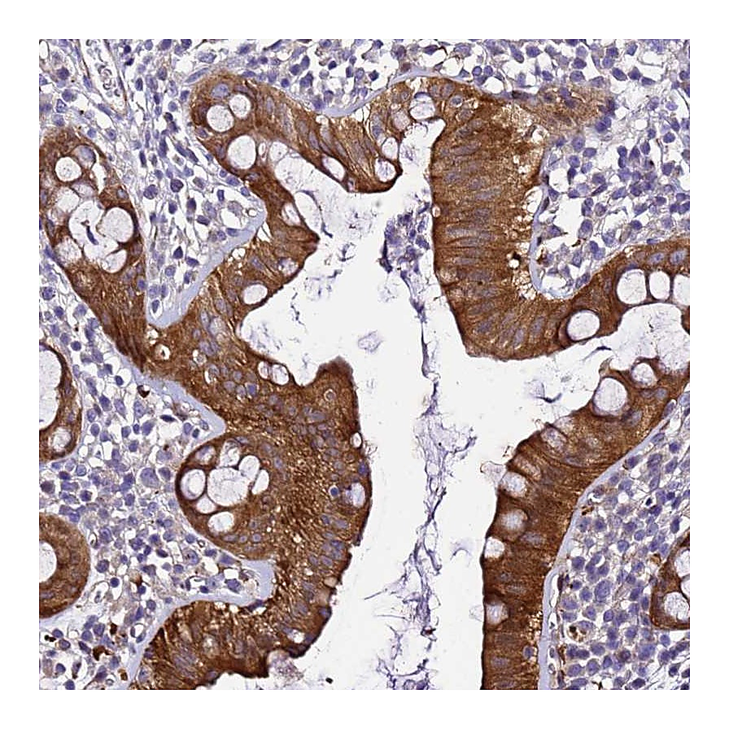 Atlas Antibodies Anti-ZNF587 Antibody