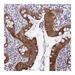 Atlas Antibodies Anti-ZNF587 Antibody