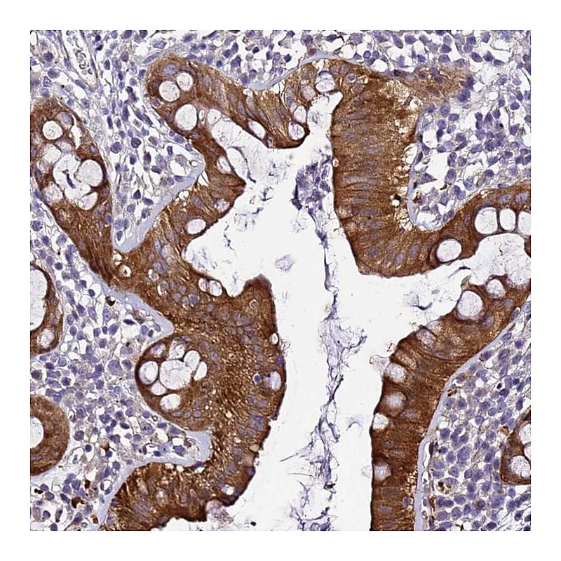 Atlas Antibodies Anti-ZNF587 Antibody
