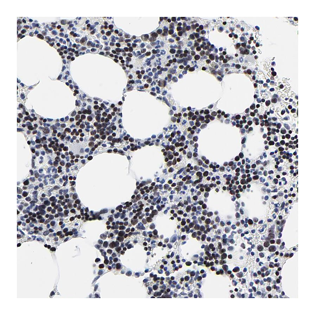 Atlas Antibodies Anti-ZNF589 Antibody
