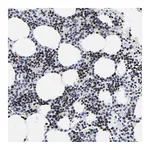 Atlas Antibodies Anti-ZNF589 Antibody
