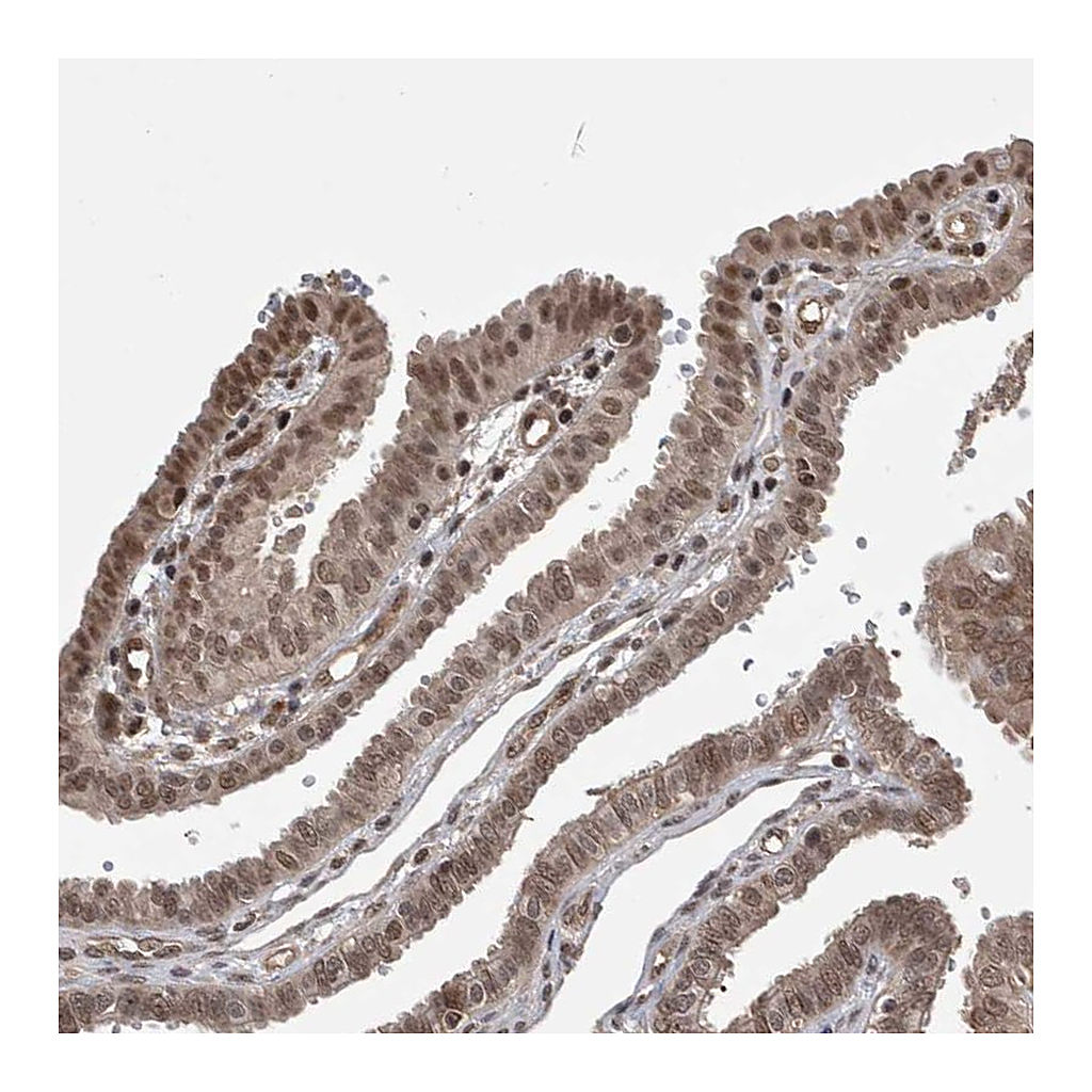 Atlas Antibodies Anti-ZNF592 Antibody