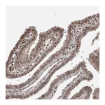 Atlas Antibodies Anti-ZNF592 Antibody