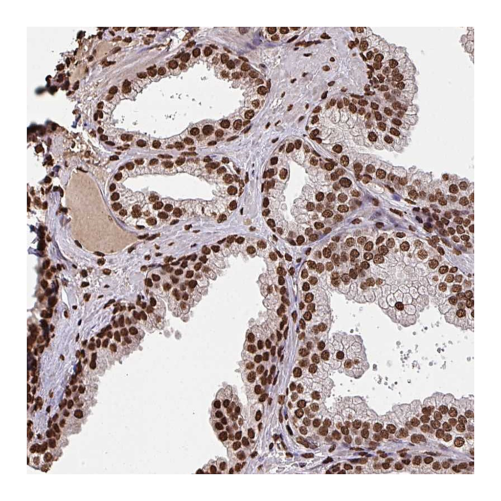 Atlas Antibodies Anti-ZNF593 Antibody
