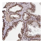 Atlas Antibodies Anti-ZNF593 Antibody