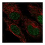 Atlas Antibodies Anti-ZNF594 Antibody