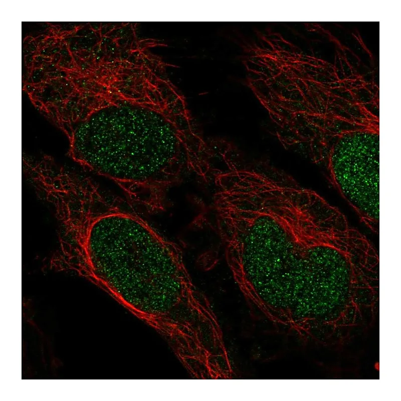 Atlas Antibodies Anti-ZNF594 Antibody