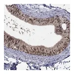 Atlas Antibodies Anti-ZNF594 Antibody