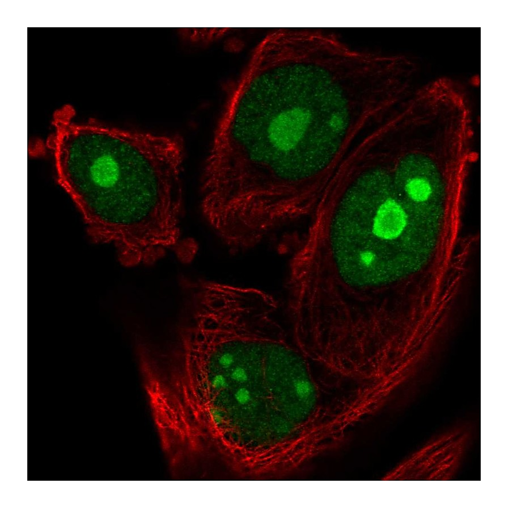Atlas Antibodies Anti-ZNF593 Antibody
