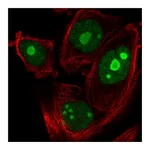 Atlas Antibodies Anti-ZNF593 Antibody