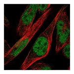 Atlas Antibodies Anti-ZNF594 Antibody