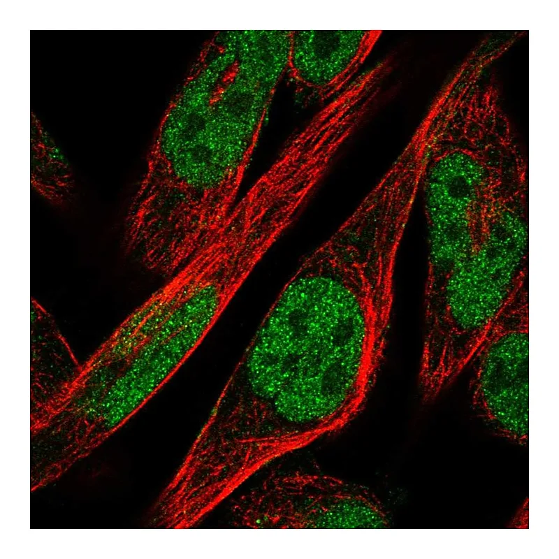 Atlas Antibodies Anti-ZNF594 Antibody