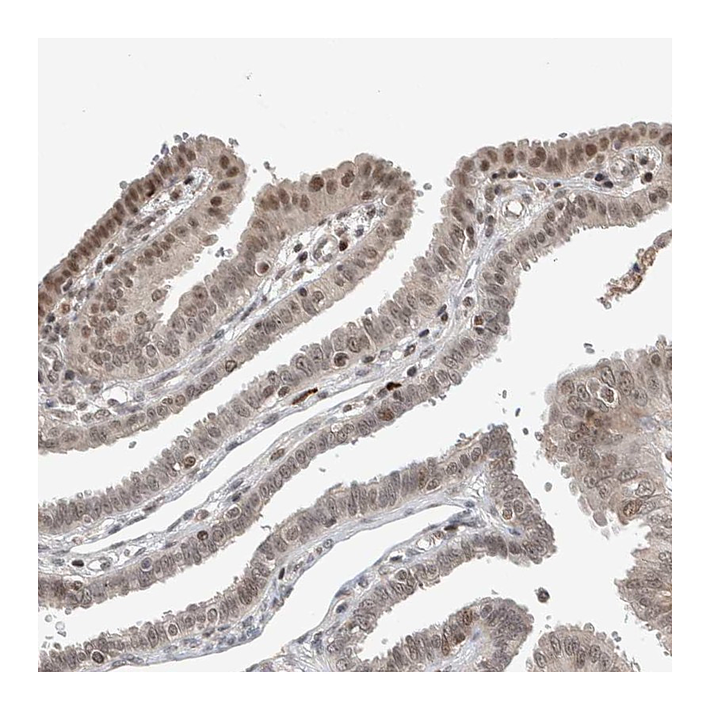 Atlas Antibodies Anti-ZNF592 Antibody