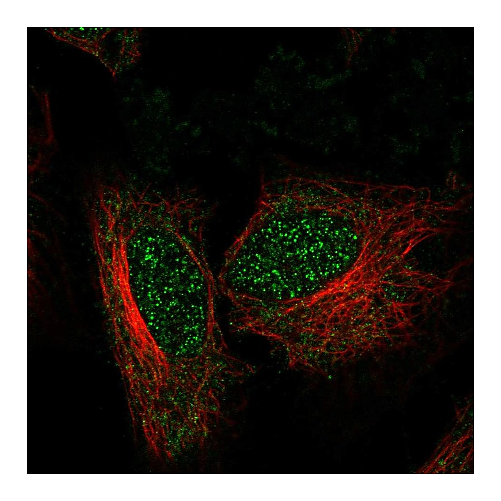 Atlas Antibodies Anti-ZNF594 Antibody