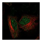 Atlas Antibodies Anti-ZNF594 Antibody
