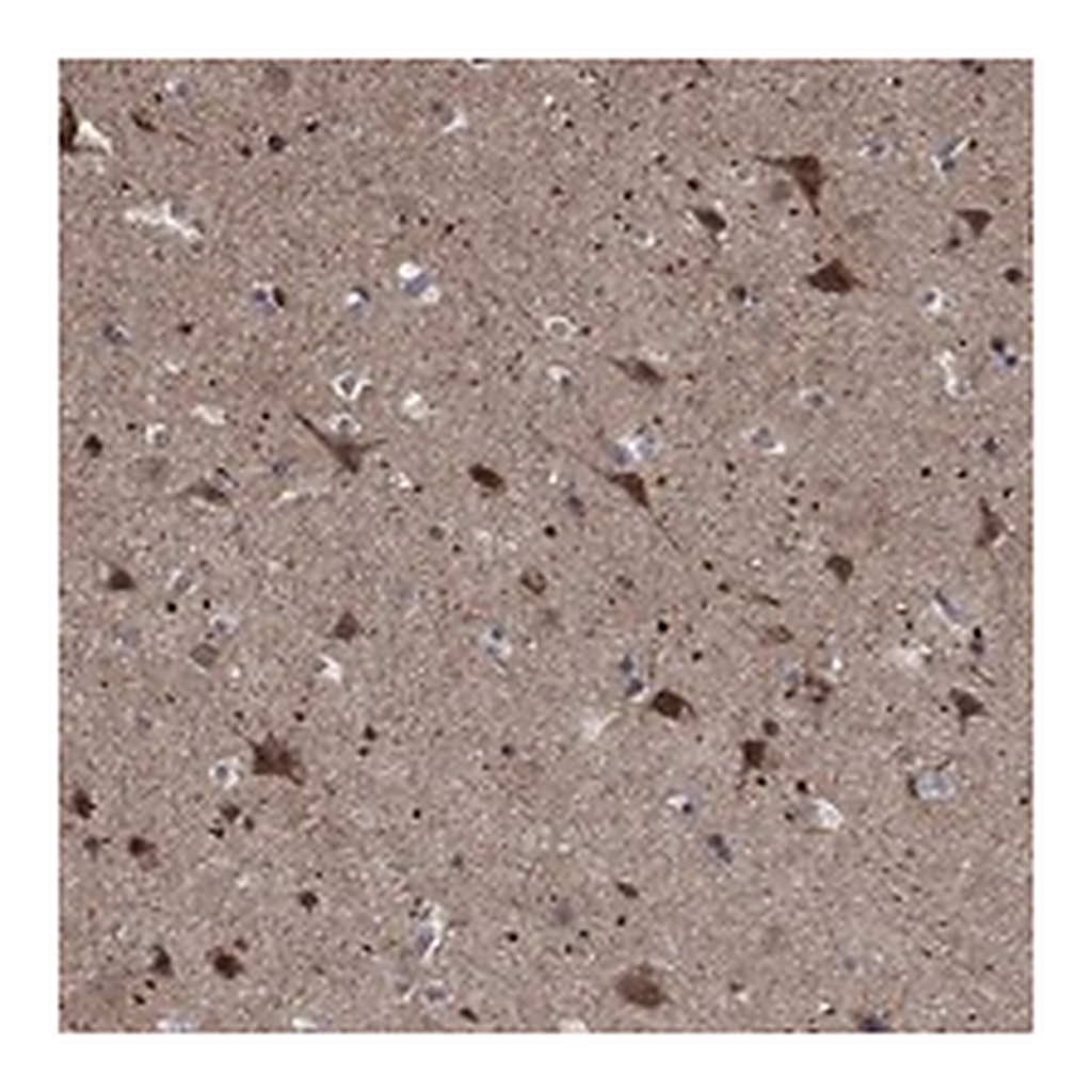 Atlas Antibodies Anti-ZNF594 Antibody