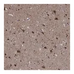Atlas Antibodies Anti-ZNF594 Antibody