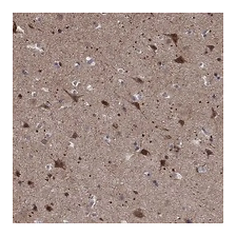 Atlas Antibodies Anti-ZNF594 Antibody