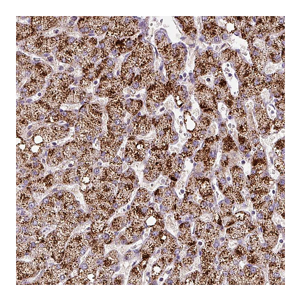 Atlas Antibodies Anti-ZNF596 Antibody