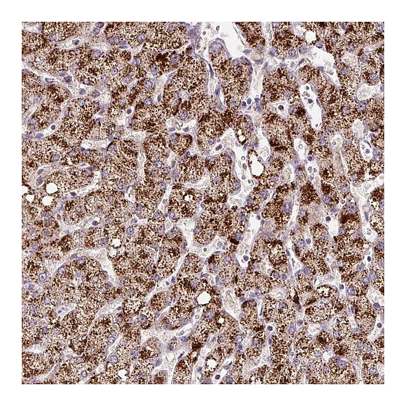 Atlas Antibodies Anti-ZNF596 Antibody