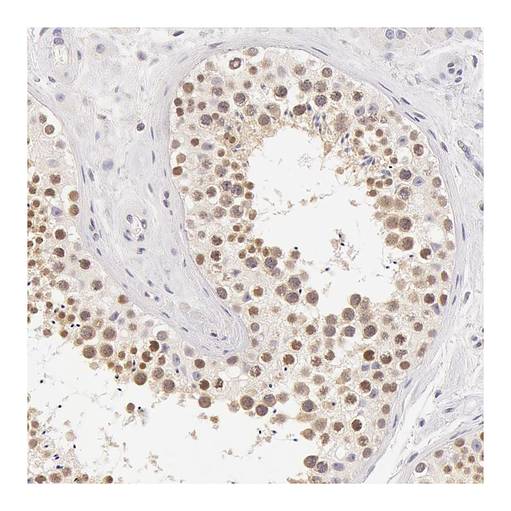Atlas Antibodies Anti-ZNF597 Antibody