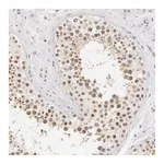 Atlas Antibodies Anti-ZNF597 Antibody
