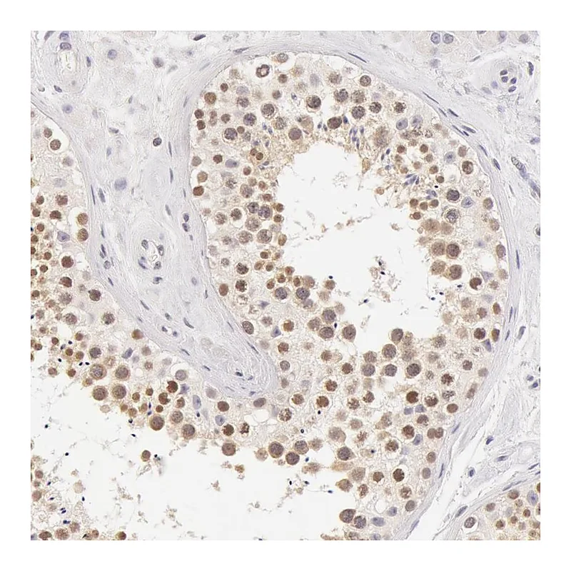 Atlas Antibodies Anti-ZNF597 Antibody