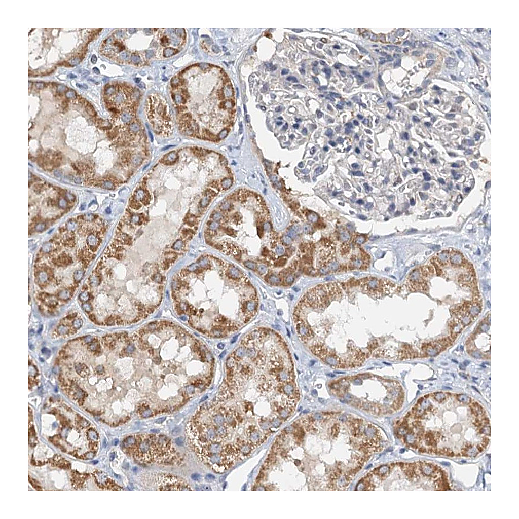 Atlas Antibodies Anti-ZNF606 Antibody