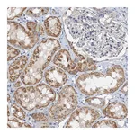 Atlas Antibodies Anti-ZNF606 Antibody