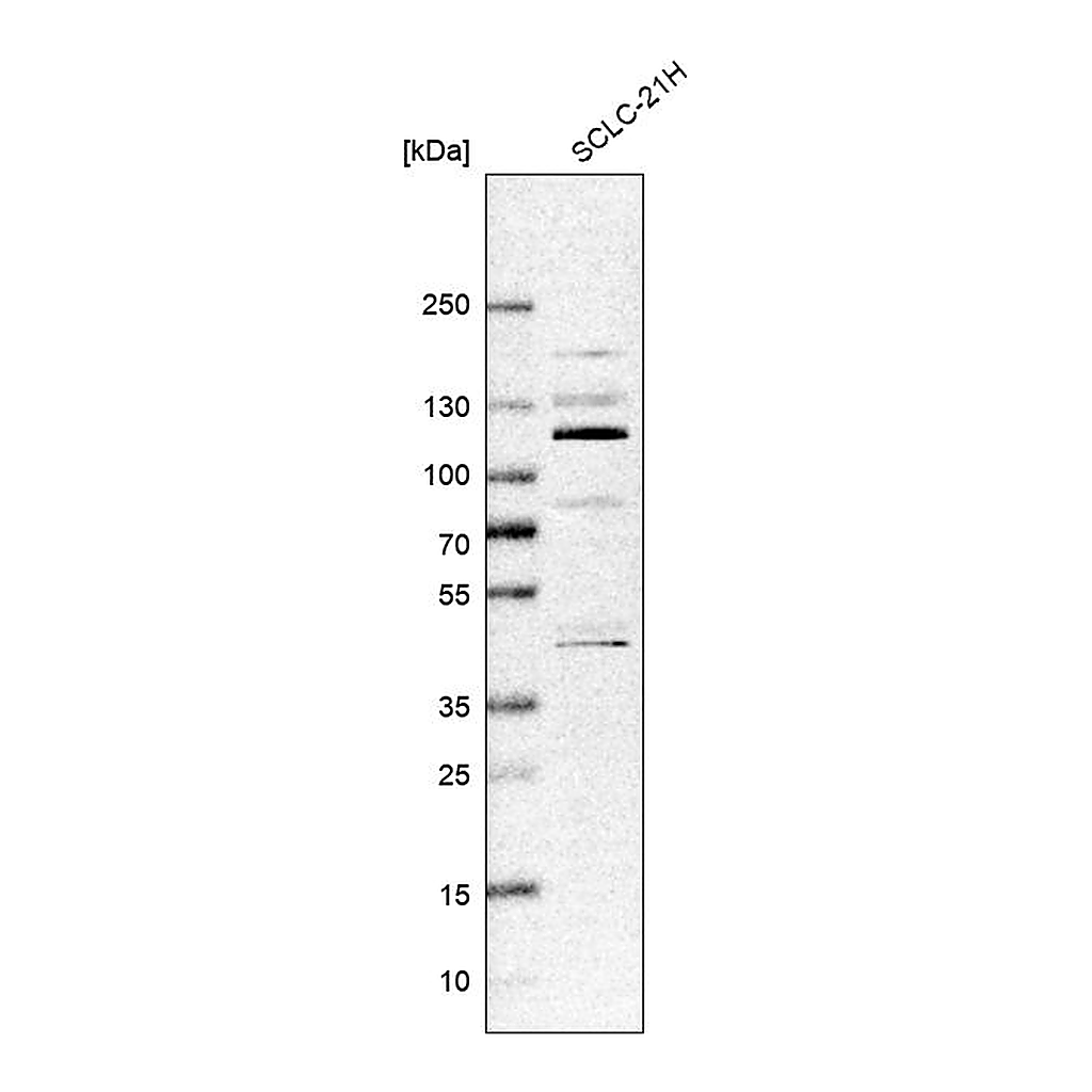 Atlas Antibodies Anti-ZNF598 Antibody