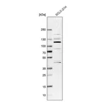 Atlas Antibodies Anti-ZNF598 Antibody