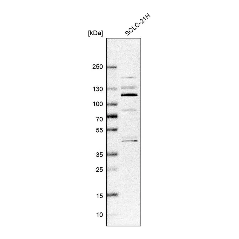 Atlas Antibodies Anti-ZNF598 Antibody