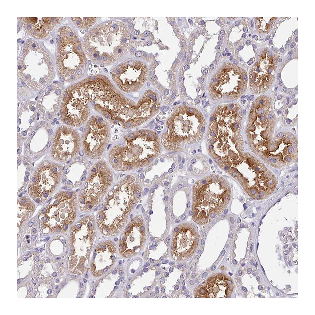 Atlas Antibodies Anti-ZNF607 Antibody
