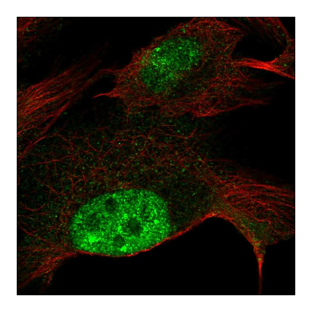 Atlas Antibodies Anti-ZNF606 Antibody